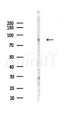 RHG18 Antibody - Western blot analysis of lysates from HUVEC cells(LPS 4h treatment), using RHG18 Antibody at 1/1000 dilution.