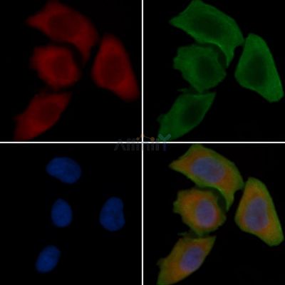 RHG18 Antibody - DF4427 staining Hela cells(30min of UV treatment) by IF/ICC.