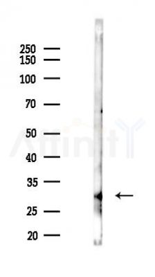 RPL7L1 Antibody - Western blot analysis of lysates from HUVEC cells(LPS 4h treatment), using RPL7L1 Antibody at 1/1000 dilution.