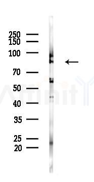 RFWD3 Antibody - Western blot analysis of lysates from K562 cells(heat-shock 45min treatment), using RFWD3 Antibody at 1/1000 dilution.