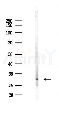PRSS33 Antibody - Western blot analysis of lysates from HUVEC cells(LPS 4h treatment), using PRSS33 Antibody at 1/1000 dilution.