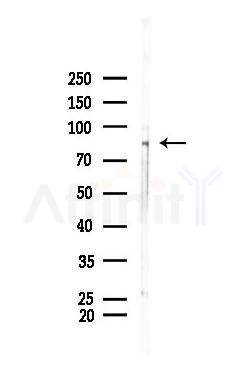 TLK2 Antibody - Western blot analysis of lysates from HUVEC cells(starvation 24h treatment), using TLK2 Antibody at 1/1000 dilution.