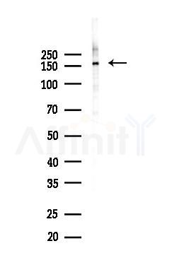 SHANK2 Antibody - Western blot analysis of lysates from COLO205 cells(heat-shock 45min treatment), using SHANK2 Antibody at 1/1000 dilution.