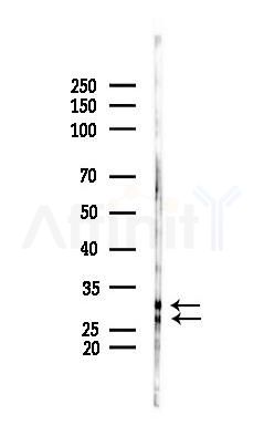 SCN4B Antibody - Western blot analysis of lysates from HUVEC cells(starvation 24h treatment), using SCN4B Antibody at 1/1000 dilution.