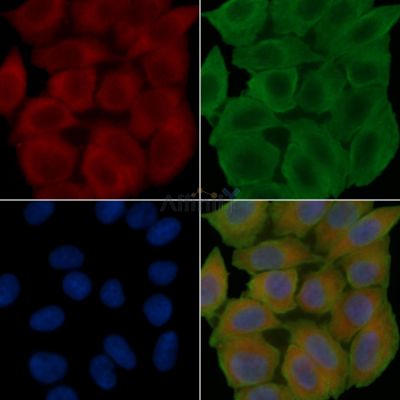 SLC9A8 Antibody - DF4519 staining Hela cells(45min of heat-shock treatment) by IF/ICC.