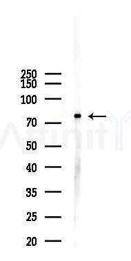 SYTL4 Antibody - Western blot analysis of lysates from Hela cells(LPS 4h treatment), using SYTL4 Antibody at 1/1000 dilution.