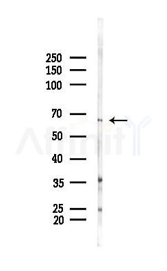 TIGD1 Antibody - Western blot analysis of lysates from HUVEC cells(starvation 24h treatment), using TIGD1 Antibody at 1/1000 dilution.