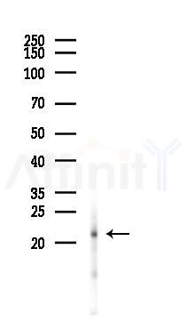 TRAPPC3 Antibody - Western blot analysis of lysates from Hela cells(LPS 4h treatment), using TRAPPC3 Antibody at 1/1000 dilution.