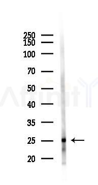 TCEAL6 Antibody - Western blot analysis of lysates from Hela cells(LPS 4h treatment), using TCEAL6 Antibody at 1/1000 dilution.