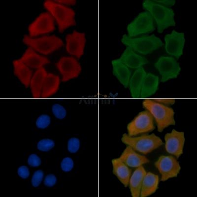 MTIF3 Antibody - DF4579 staining Hela cells(45min of heat-shock treatment) by IF/ICC.