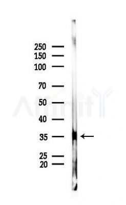 TMBIM1 Antibody - Western blot analysis of lysates from HUVEC cells(starvation 24h treatment), using TMBIM1 Antibody at 1/1000 dilution.
