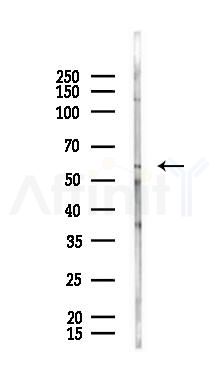 USP30 Antibody - Western blot analysis of lysates from Rat kidney, using USP30 Antibody at 1/1000 dilution.