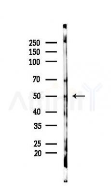 UEVLD Antibody - Western blot analysis of lysates from Rat lung, using UEVLD Antibody at 1/1000 dilution.
