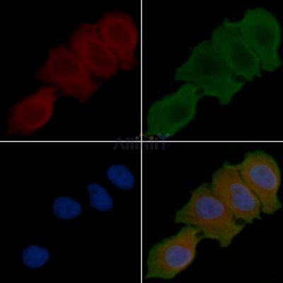 UEVLD Antibody - DF4602 staining Hela cells(30min of UV treatment) by IF/ICC.