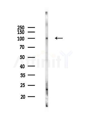 ZC3H11A Antibody - Western blot analysis of lysates from HUVEC cells(starvation 24h treatment), using ZC3H11A Antibody at 1/1000 dilution.