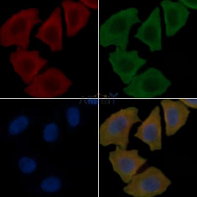 CA181 Antibody - DF4643 staining Hela cells(45min of heat-shock treatment) by IF/ICC.