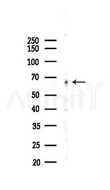 EME1 Antibody - Western blot analysis of lysates from 293 cells(heat-shock 45min treatment), using EME1 Antibody at 1/1000 dilution.