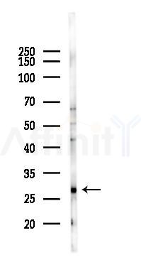 SIRT3 Antibody - Western blot analysis of lysates from Hela cells(LPS 4h treatment), using SIRT3 Antibody at 1/1000 dilution.