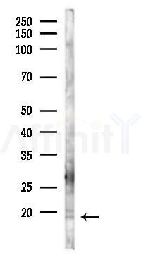 IL4 Antibody - Western blot analysis of lysates from Mouse brain, using IL4 Antibody at 1/1000 dilution.