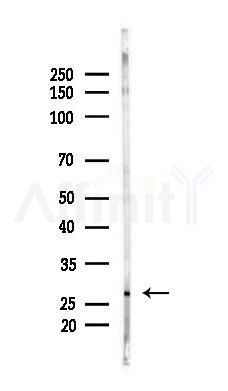 MYL3 Antibody - Western blot analysis of lysates from Mouse lung, using MYL3 Antibody at 1/1000 dilution.