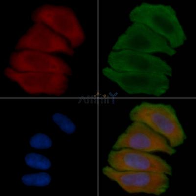 TMEM101 Antibody - DF4740 staining Hela cells(30min of UV treatment) by IF/ICC.