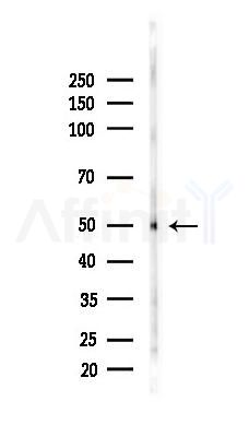 Cytochrome P450 3A7 Antibody - Western blot analysis of lysates from Rat kidney, using Cytochrome P450 3A7 Antibody at 1/1000 dilution.