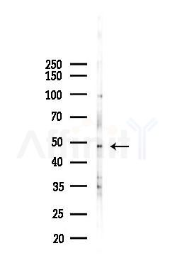 Cytochrome P450 2D6 Antibody - Western blot analysis of lysates from 293 cells(heat-shock 45min treatment), using Cytochrome P450 2D6 Antibody at 1/1000 dilution.