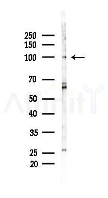 LRP8 Antibody - Western blot analysis of lysates from Mouse lung, using LRP8 Antibody at 1/1000 dilution.