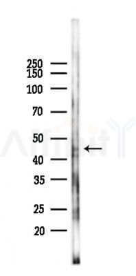 LAMP1 Antibody - Western blot analysis of lysates from COLO205 cells(starvation 24h treatment), using LAMP1 Antibody at 1/1000 dilution.