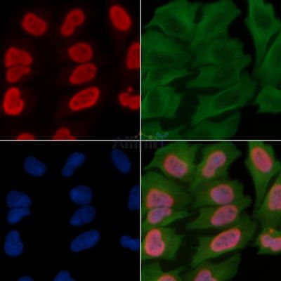 Acetyl-Histone H4 (Lys5) Antibody - DF4842 staining Hela cells(45min of heat-shock treatment) by IF/ICC.