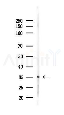 CLTR1 Antibody - Western blot analysis of lysates from Rat kidney, using CLTR1 Antibody at 1/1000 dilution.