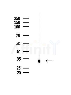 OR10C1 Antibody - Western blot analysis of lysates from B16F10-LUC cells(LPS 4h treatment), using OR10C1 Antibody at 1/1000 dilution.