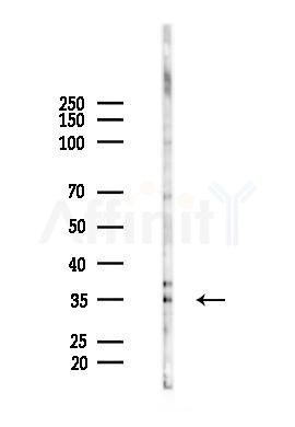 OR52A4 Antibody - Western blot analysis of lysates from Rat lung, using OR52A4 Antibody at 1/1000 dilution.