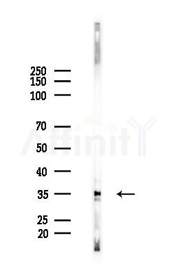 OR4K14 Antibody - Western blot analysis of lysates from Rat lung, using OR4K14 Antibody at 1/1000 dilution.