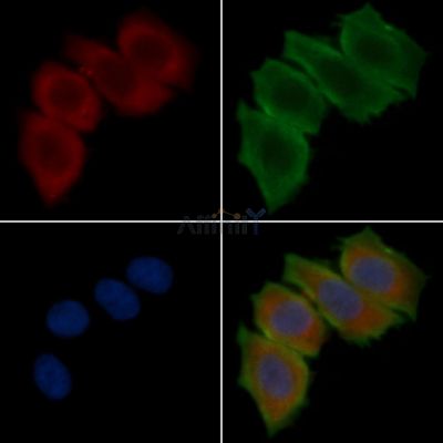 TAS2R13 Antibody - DF5158 staining Hela cells(30min of UV treatment) by IF/ICC.