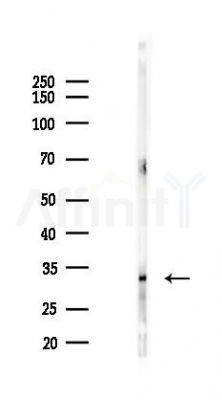 OR10H1 Antibody - Western blot analysis of lysates from HUVEC cells(LPS 4h treatment), using OR10H1 Antibody at 1/1000 dilution.