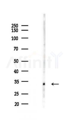 OR51A4 Antibody - Western blot analysis of lysates from HUVEC cells(LPS 4h treatment), using OR51A4 Antibody at 1/1000 dilution.