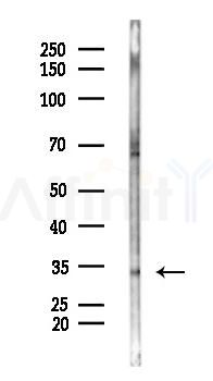 OR8G2 Antibody - Western blot analysis of lysates from COLO205 cells(UV 30min treatment), using OR8G2 Antibody at 1/1000 dilution.