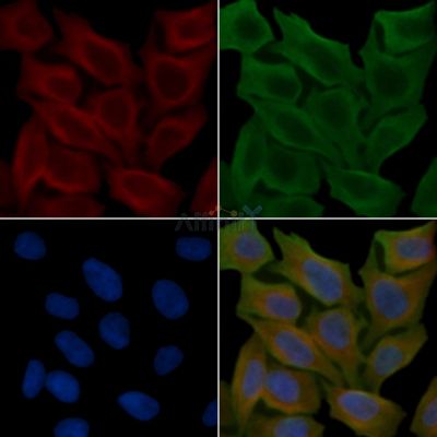 PAR4 Antibody - DF5212 staining Hela cells(45min of heat-shock treatment) by IF/ICC.