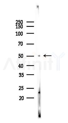 ATF4 Antibody - Western blot analysis of lysates from COLO205 cells(starvation 24h treatment), using ATF4 Antibody at 1/1000 dilution.