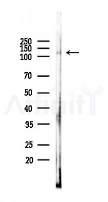 SirT1 Antibody - Western blot analysis of lysates from 293 cells(heat-shock 45min treatment), using SirT1 Antibody at 1/1000 dilution.