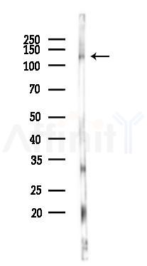 SirT1 Antibody - Western blot analysis of lysates from Mouse heart, using SirT1 Antibody at 1/1000 dilution.