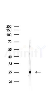 Interferon gamma Antibody - Western blot analysis of lysates from Rat liver, using Interferon gamma Antibody at 1/1000 dilution.