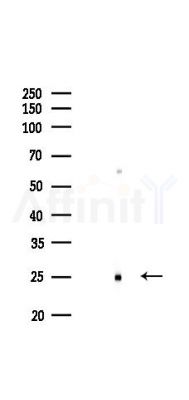 Interferon gamma Antibody - Western blot analysis of lysates from Mouse kidney, using Interferon gamma Antibody at 1/1000 dilution.