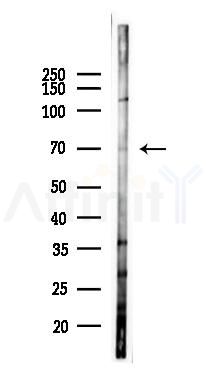 TBRG4 Antibody - Western blot analysis of lysates from 293 cells(heat-shock 45min treatment), using TBRG4 Antibody at 1/1000 dilution.