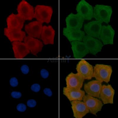 Hsp90 alpha Antibody - DF6101 staining Hela cells(30min of UV treatment) by IF/ICC.