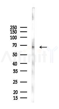 TCTN3 Antibody - Western blot analysis of lysates from B16F10-LUC cells(heat-shock 45min treatment), using TCTN3 Antibody at 1/1000 dilution.