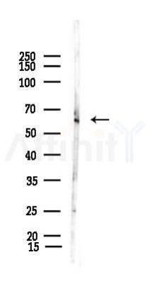 WASP Antibody - Western blot analysis of lysates from Mouse spleen, using WASP Antibody at 1/1000 dilution.