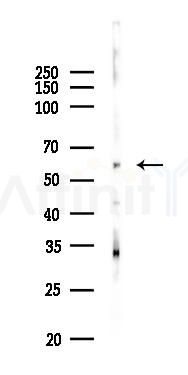 BIRC2 Antibody - Western blot analysis of lysates from Hela cells(heat-shock 45min treatment), using BIRC2 Antibody at 1/1000 dilution.