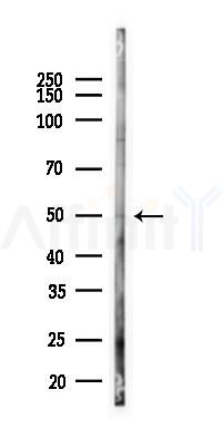 NCK1 Antibody - Western blot analysis of lysates from Hela cells(heat-shock 45min treatment), using NCK1 Antibody at 1/1000 dilution.
